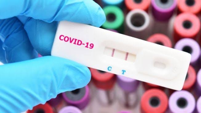 Pengadaan Rapid Test di Dinkes Kota Serang  Rp4,4 Miliar Diselidiki Kejari Serang