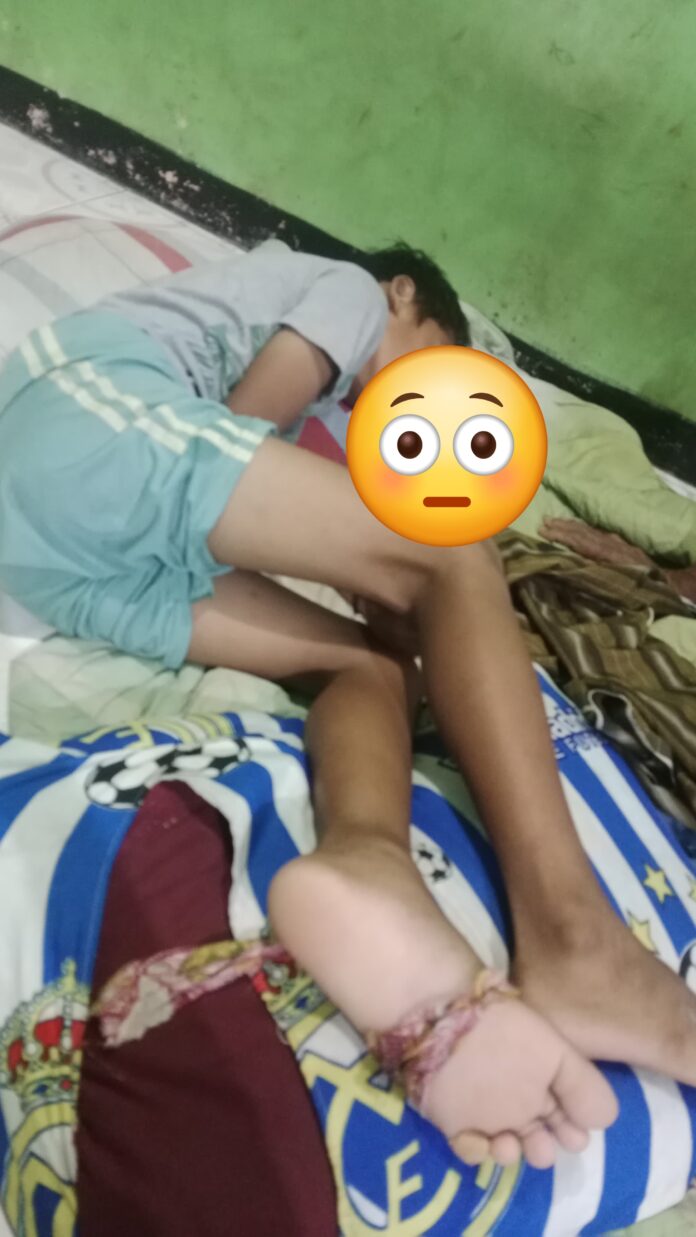 Bocah Pulau Tunda3 Miris! Bocah di Pulau Tunda Kabupaten Serang Disengat Ikan Beracun, Tenaga Medis Tak Ada di Tempat.