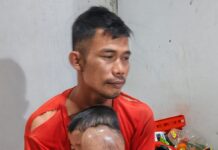 Balita di Pandeglang Derita Tumor Ganas : Mau Berobat Tak Punya Biaya, Bantuan Pemerintah Tak Ada Farhan dipangku bapaknya.