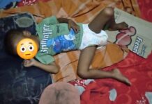 Tak Punya Uang Untuk Berobat , Balita Penderita Stunting dekat SPPG di Kota Serang Pasrah Juned,Kenari.